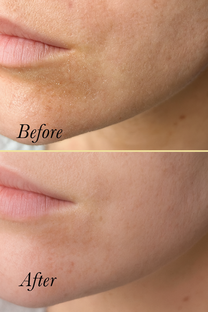 Rosehip Face Polish